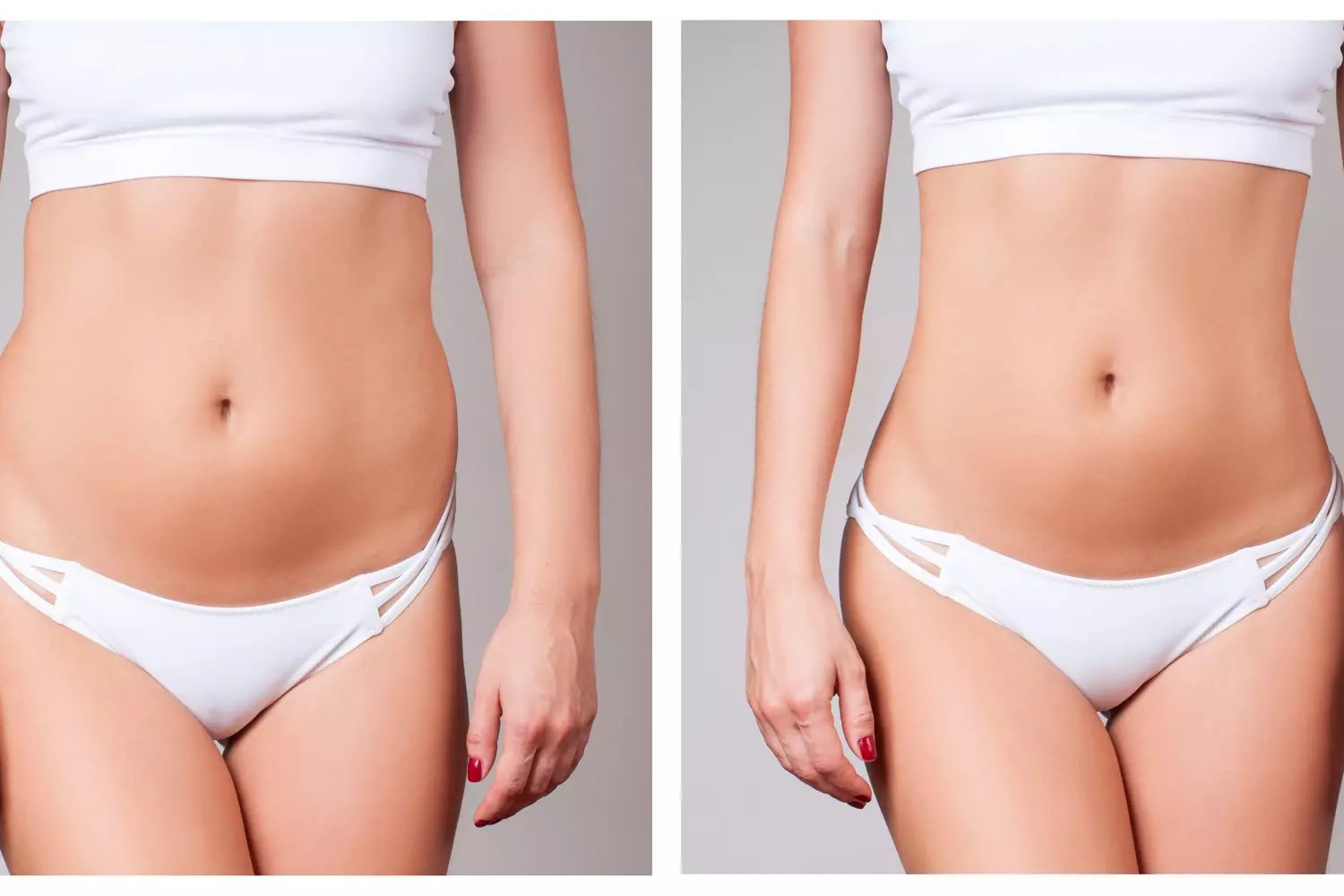 Implants pectoraux