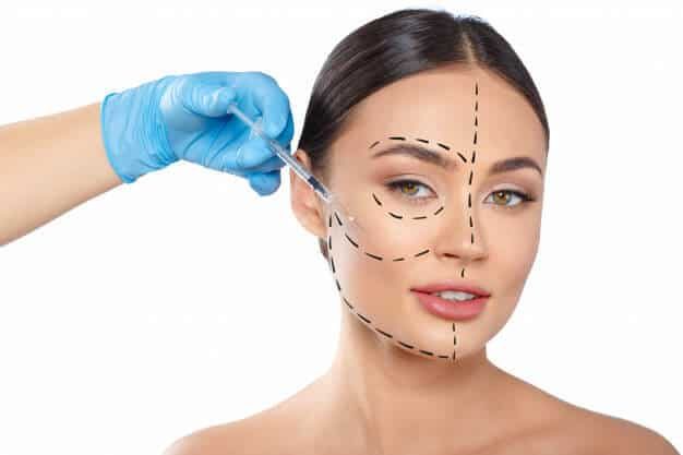 Lifting du visage